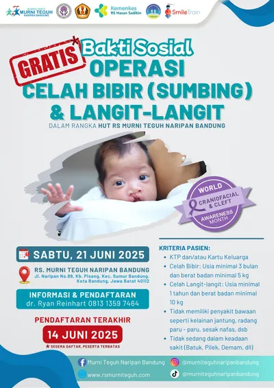 Operasi Sumbing Gratis untuk Anak dan Dewasa di RS Murni Teguh Bandung